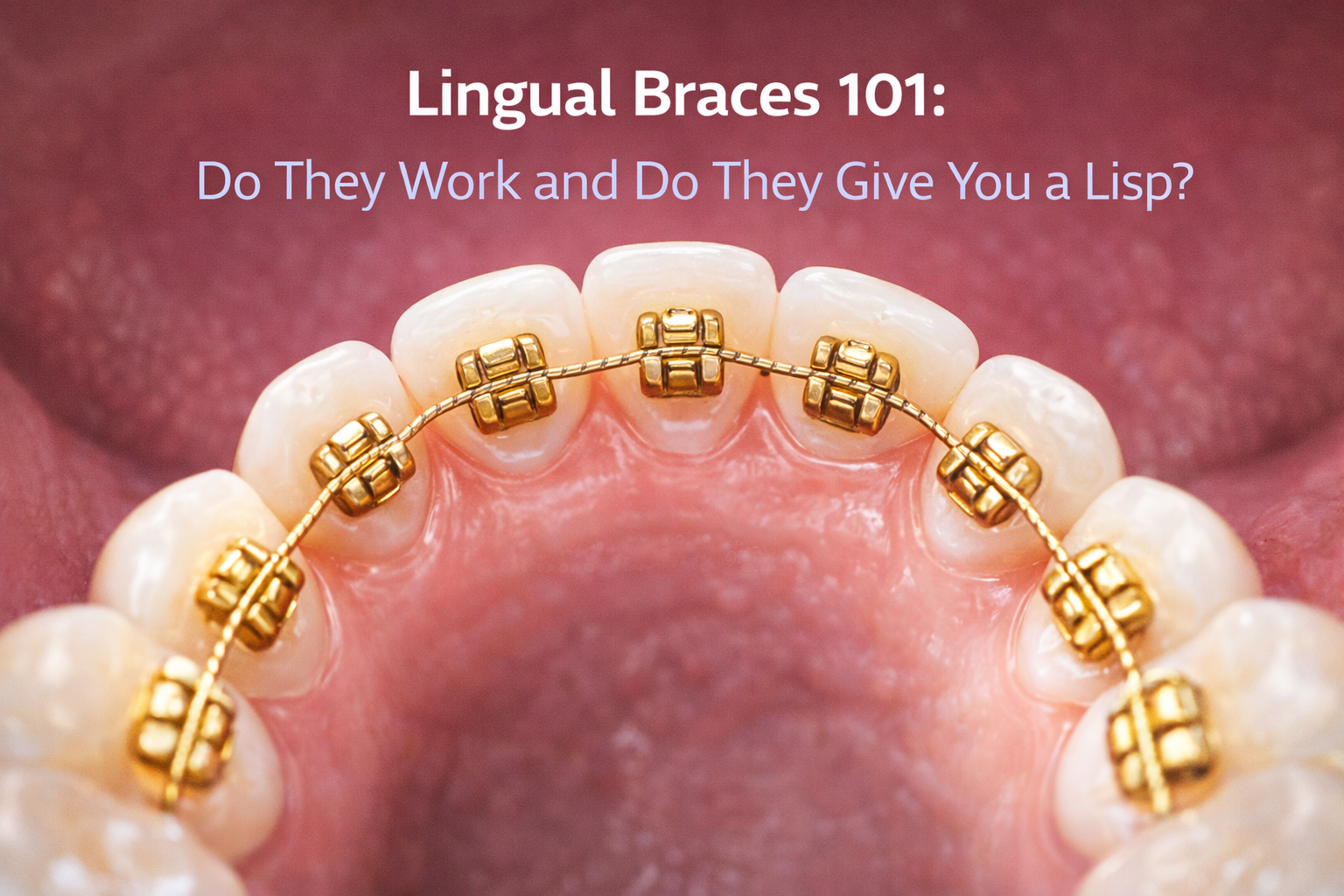 Gold lingual braces up close